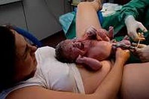 painfree childbirth